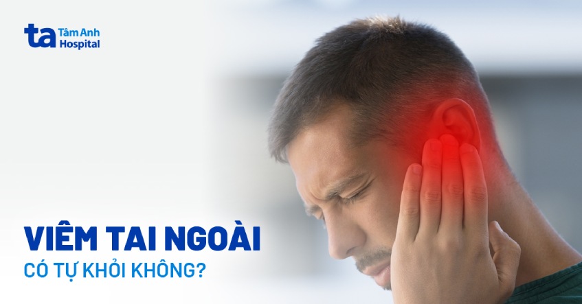 Viêm tai ngoài có tự khỏi được không? Mất bao lâu thì khỏi bệnh?