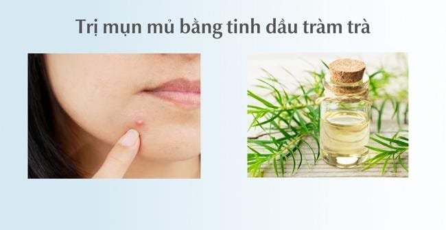 Top 13 cách trị mụn mủ hiệu quả, an toàn, không thâm sẹo