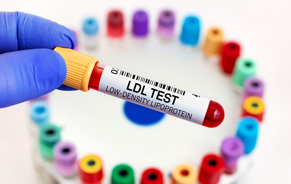 Xét nghiệm định lượng LDL cholesterol trong máu