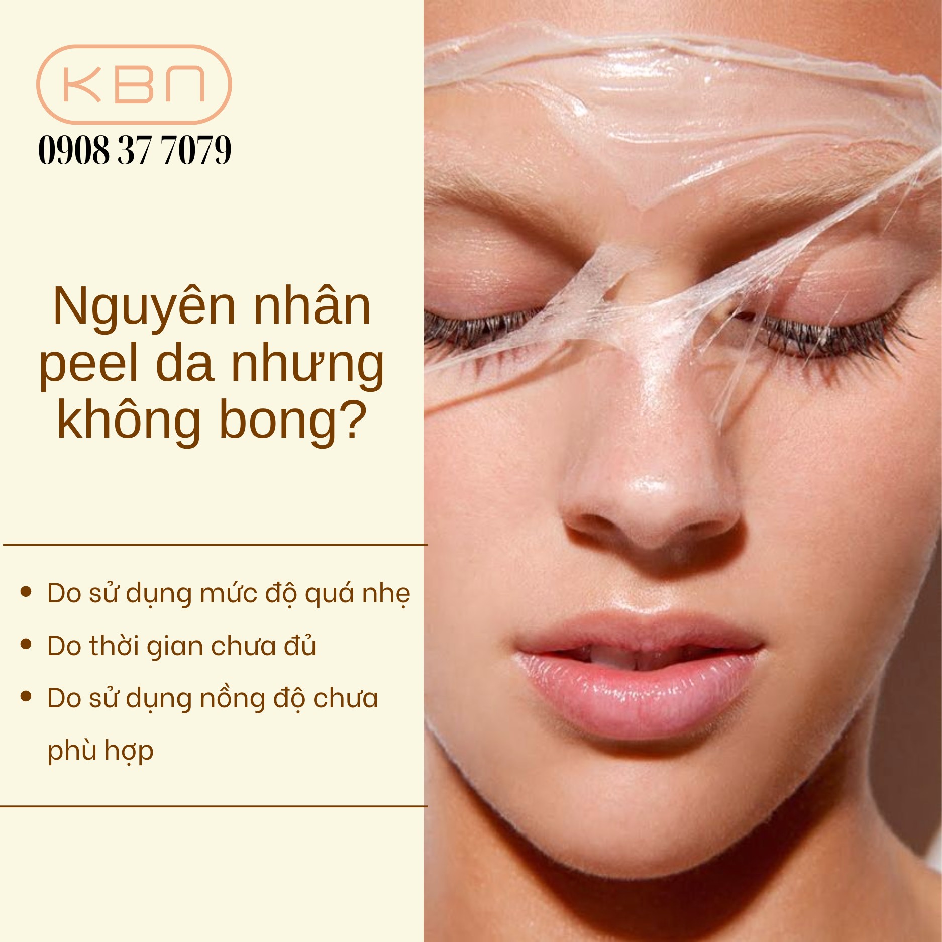 Peel da nhưng không bong phải làm sao?