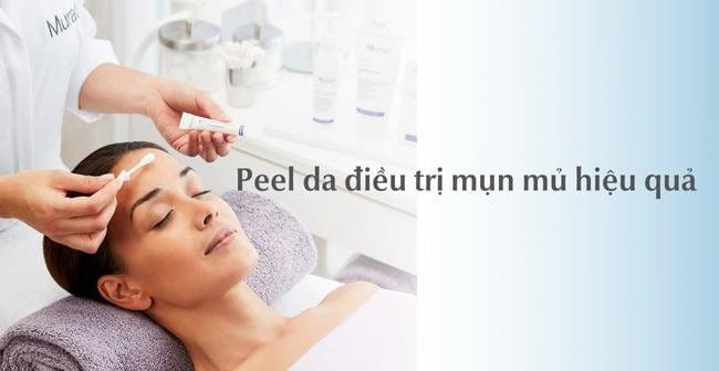 Top 13 cách trị mụn mủ hiệu quả, an toàn, không thâm sẹo