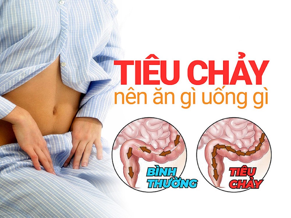 Tiêu chảy ăn gì, kiêng gì để mau hồi phục?