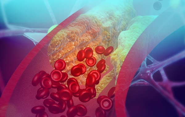 Xét nghiệm HDL cholesterol (HDL-C) là gì?