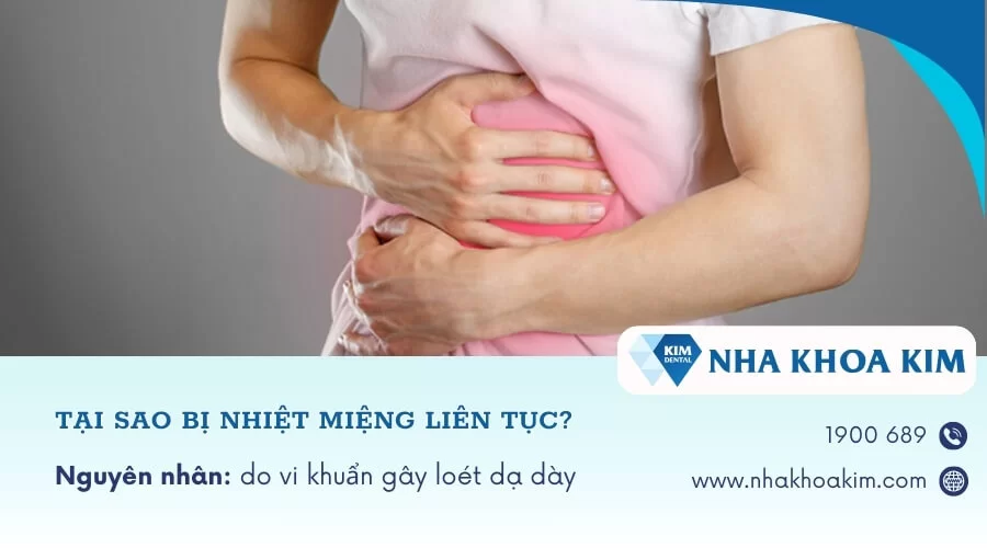 Tại sao bị nhiệt miệng liên tục, tái đi tái lại nhiều lần?