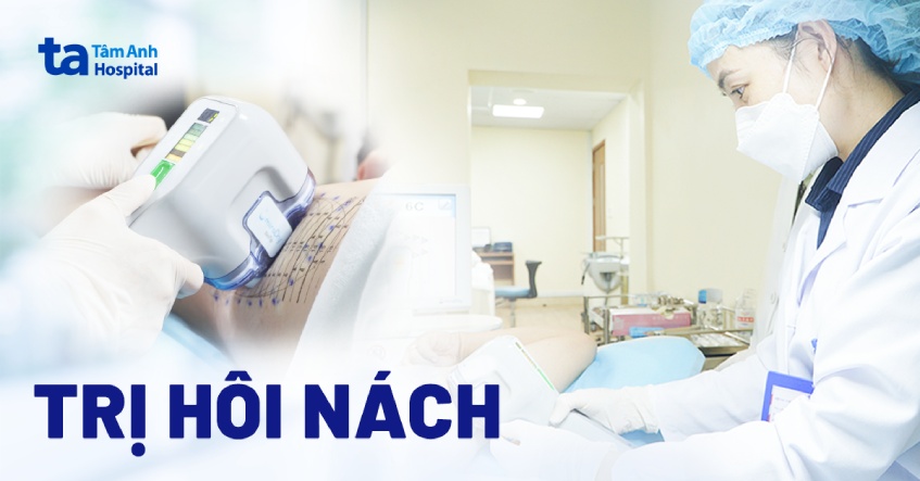 4 cách trị hôi nách triệt để tận gốc vĩnh viễn chuẩn y khoa