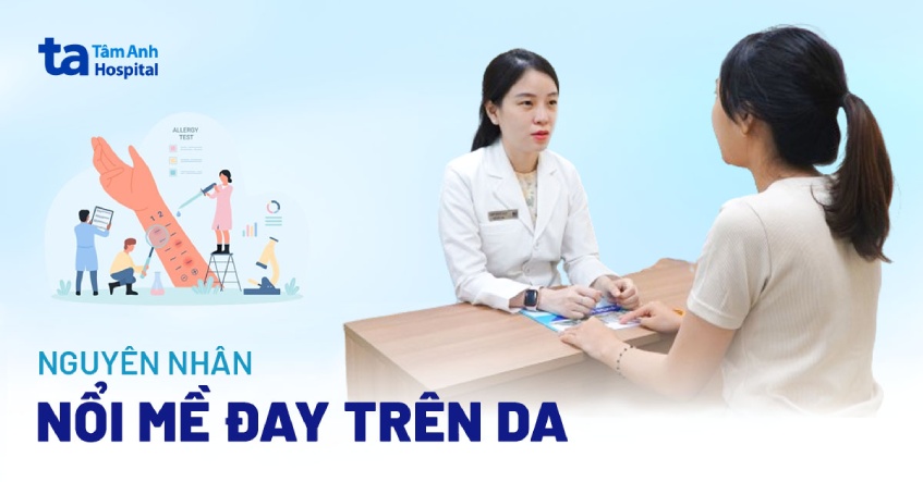 10 nguyên nhân nổi mề đay trên da thường gặp và cách nhận biết