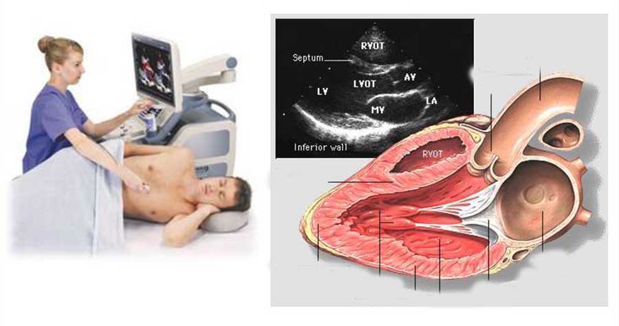 Siêu âm đầu dò âm đạo là gì, giá siêu âm đầu dò, một số lưu ý