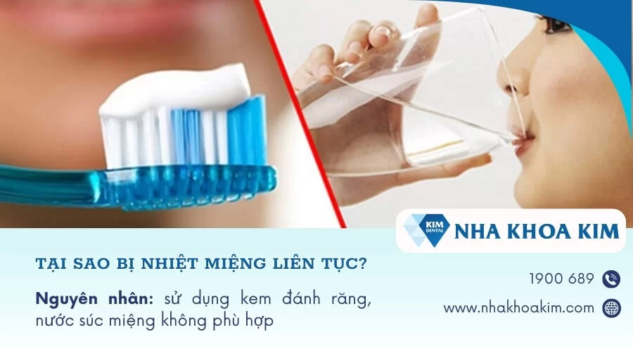 Tại sao bị nhiệt miệng liên tục, tái đi tái lại nhiều lần?