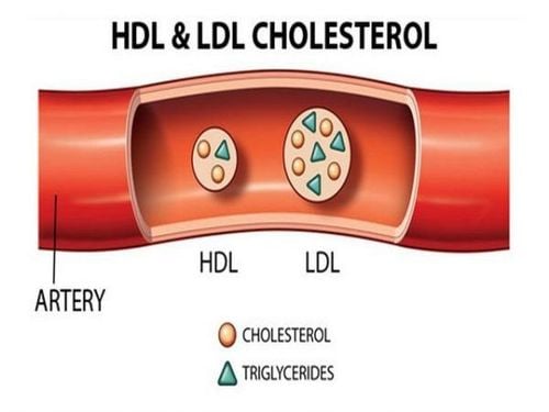 Tìm hiểu về xét nghiệm cholesterol toàn phần