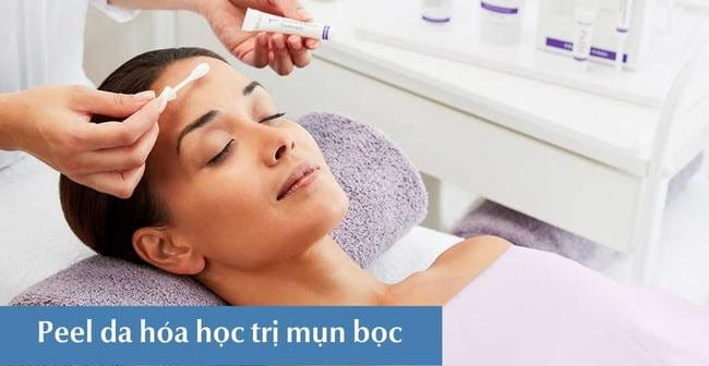 Mụn bọc bao lâu thì chín? Mụn bọc có tự xẹp được hay không?