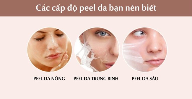 Peel Da Là Gì Có Tốt Không? Có Tác Dụng Gì Đối Với Làn Da?