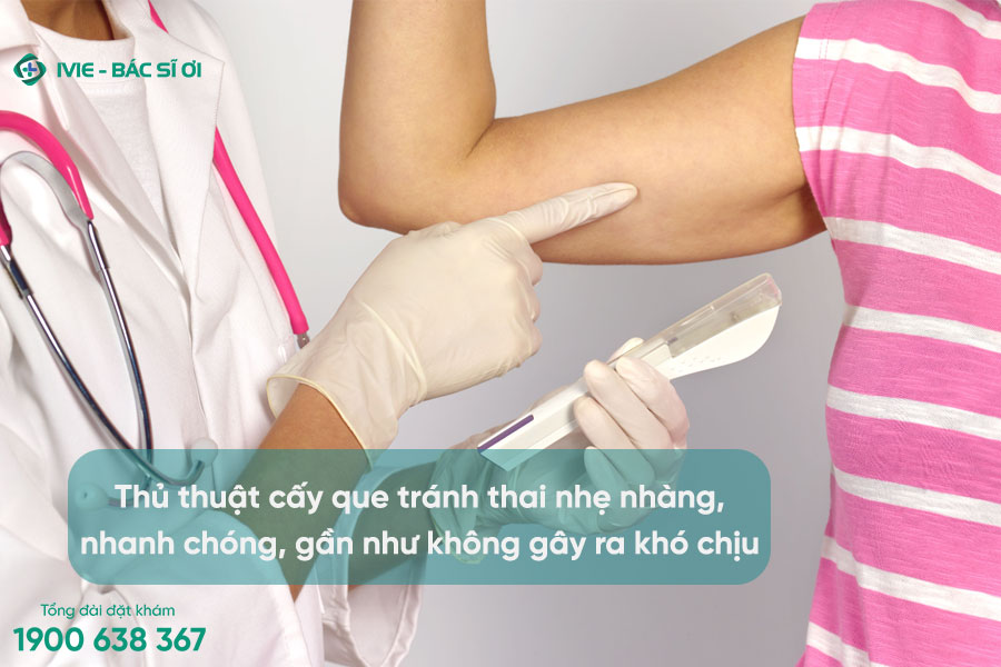 Cấy que tránh thai có tốt không? Chi phí bao nhiêu?