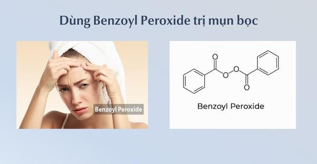 Mụn bọc bao lâu thì chín? Mụn bọc có tự xẹp được hay không?