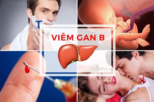 Căn bệnh nguy hiểm viêm gan B lây qua những con đường nào?