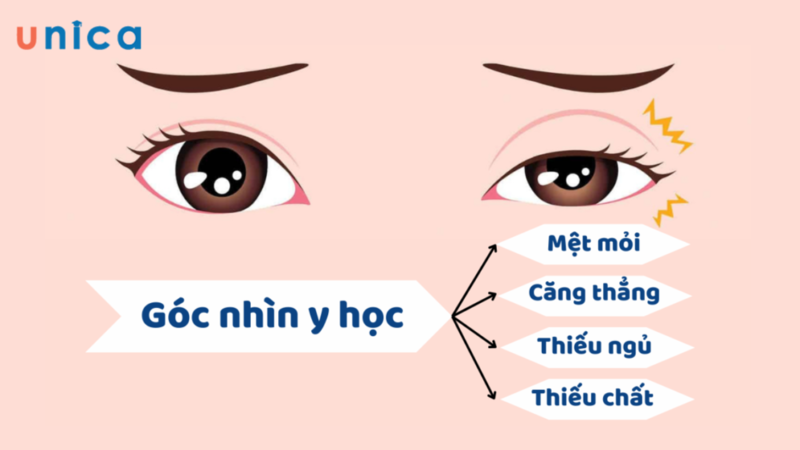 Mắt trái giật ở nữ và nam là điềm báo gì, hên hay xui?