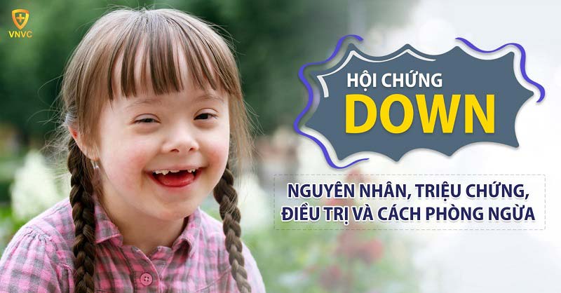 Hội chứng Down: Nguyên nhân, triệu chứng, điều trị và cách phòng ngừa