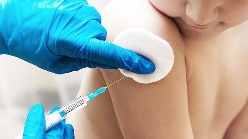 Vắc-xin Sởi - Quai bị - Rubella tiêm khi nào?