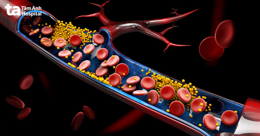 Cholesterol là gì? Có mấy loại? Chức năng, vai trò và cấu tạo