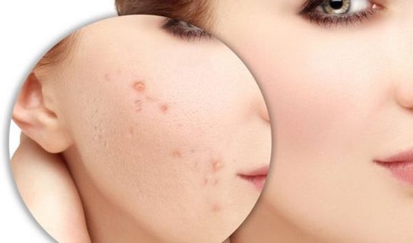 Các bước chăm sóc da cơ bản cho người mới bắt đầu Thanh Chân Cosmetics cửa hàng mỹ phẩm chính hãng