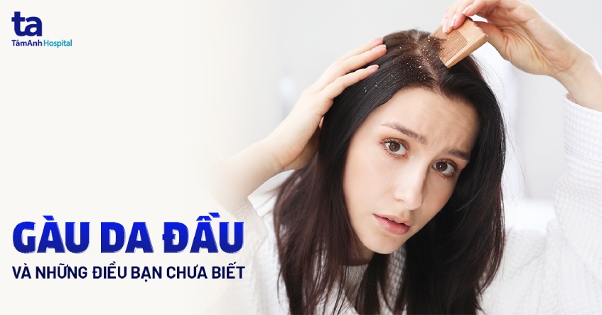 Gàu là gì? 10 nguyên nhân và triệu chứng phổ biến bạn cần biết