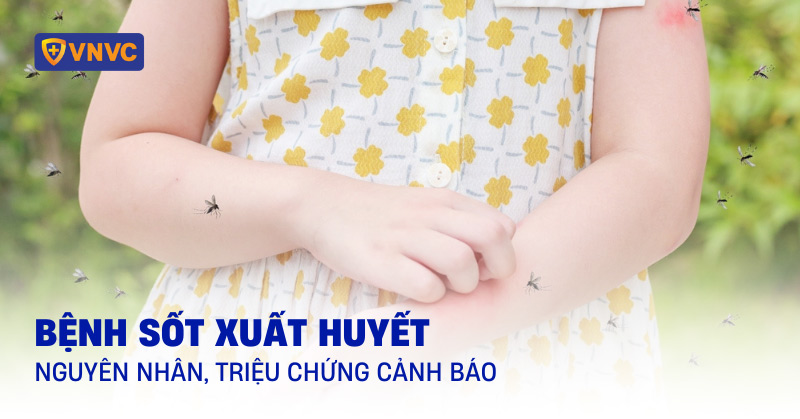 Sốt xuất huyết: Triệu chứng và nguyên nhân cảnh báo bệnh