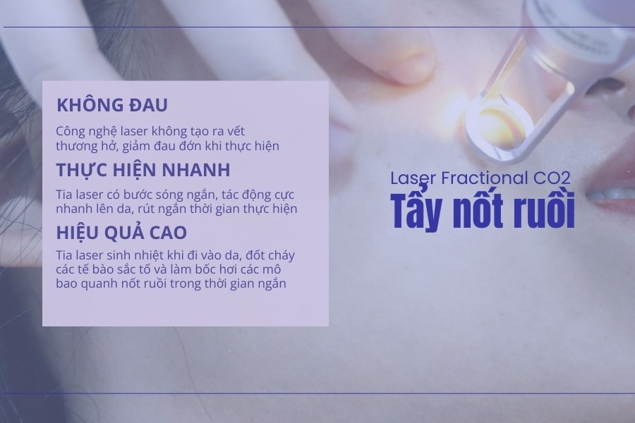 Nốt ruồi ở nách mang ý nghĩa tốt hay xấu? Có nên xóa không?